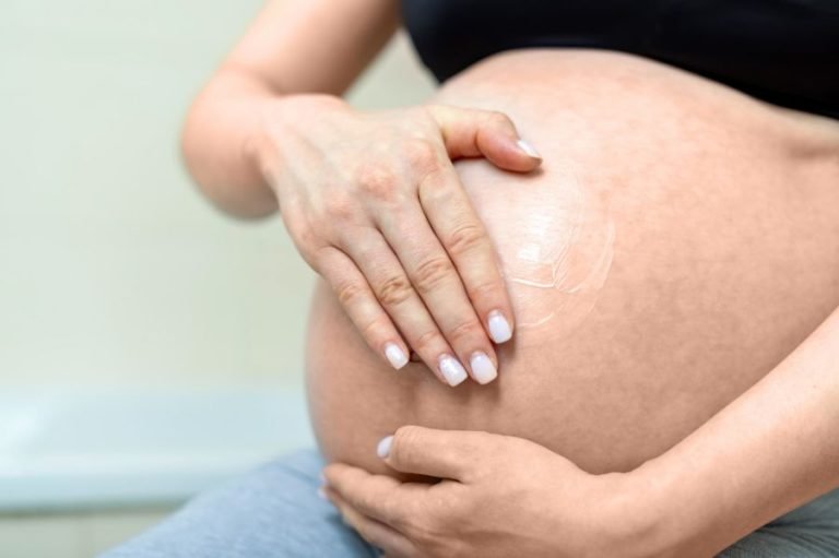 8 Cara Menghilangkan Bekas Stretch Mark Setelah Melahirkan secara Alami