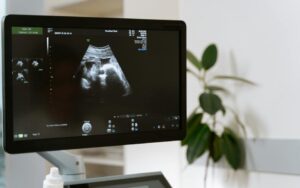 Apa itu Bayi Sungsang? Simak Jenis Posisi dan Penyebabnya!